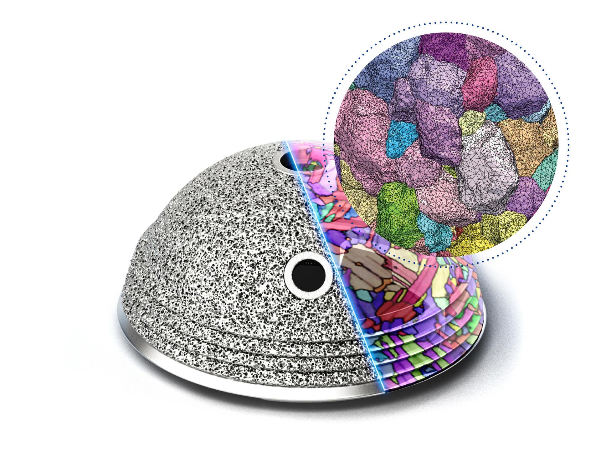 Inspección de la calidad del material tras la impresión de implantes de fabricación aditiva