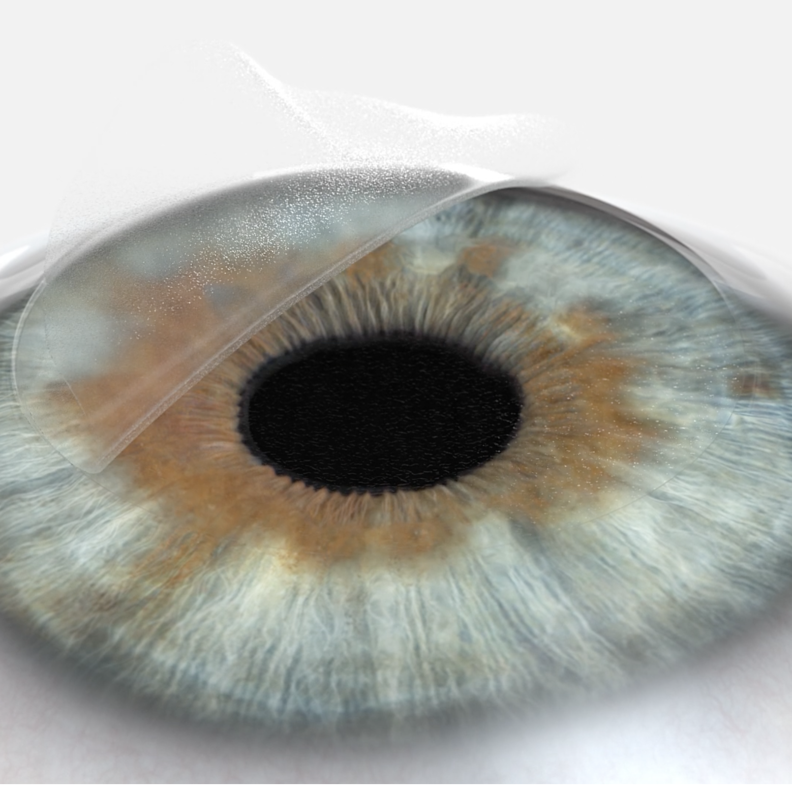 Cirugía ocular con láser LASIK | ZEISS