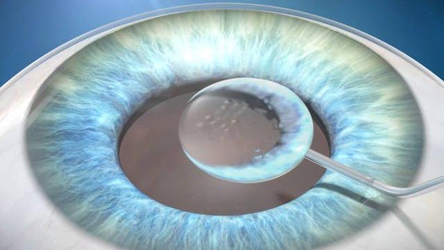 Protección de las estructuras internas del ojo