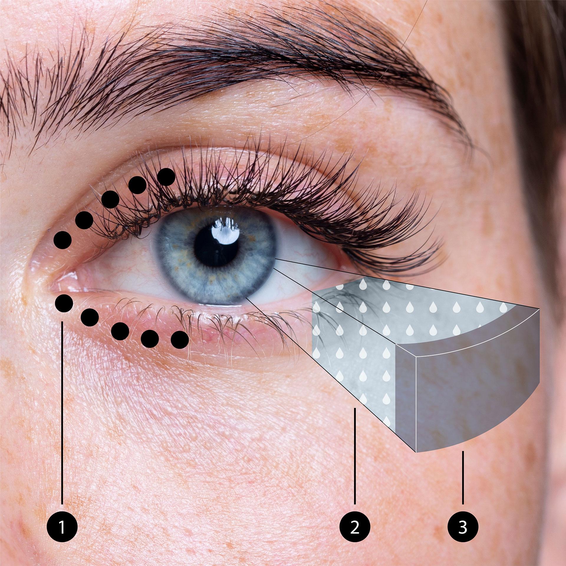 Imagen de un ojo, que muestra la ubicación de las glándulas de meibomio en los párpados y la capa de meibum sobre el líquido lagrimal del ojo.