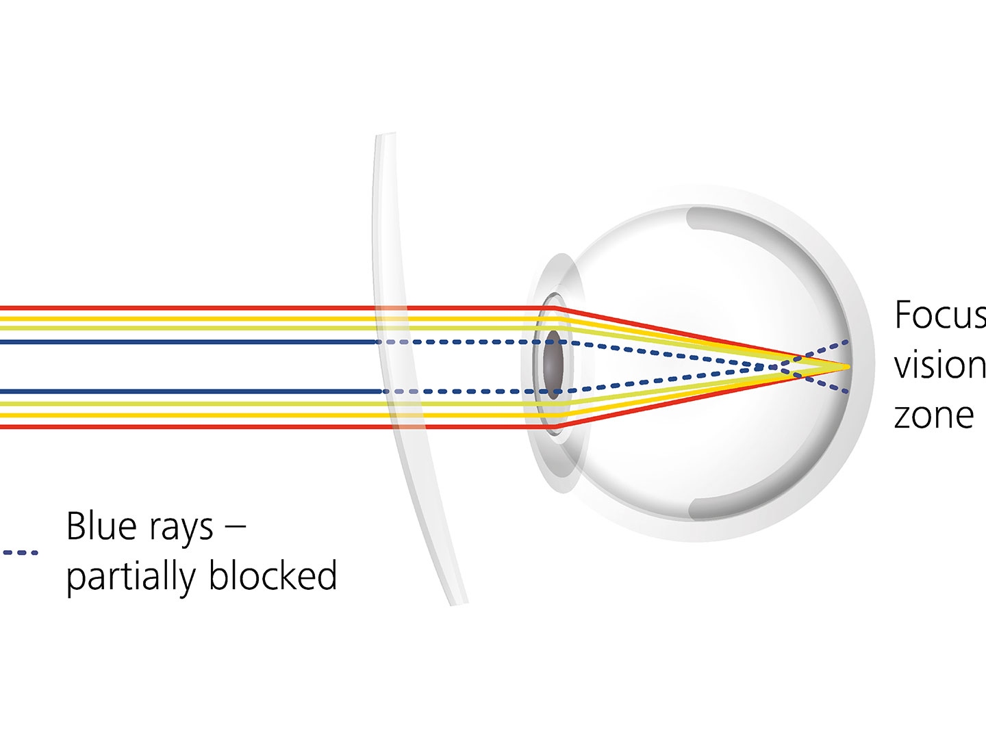Visualización de cómo los tratamientos para lentes pueden reducir el deslumbramiento al bloquear parcialmente los rayos azules 